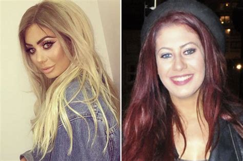 chloe ferry before surgery geordie shore|chloe ferry before plastic surgery.